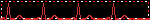 pulse .gif